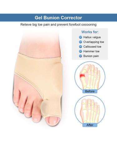 Bunion Corrector & Relief Sleeve - Hallux Valgus Guard for Women, Men - Toe Separator Spacers - Buy Online on GoSupps.com