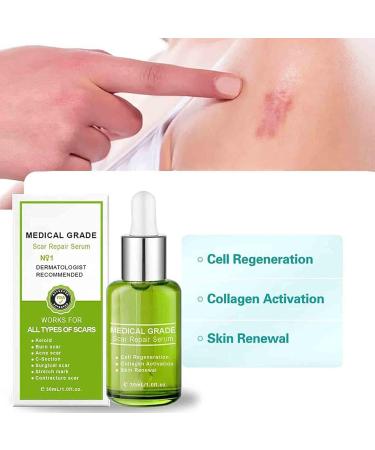 Advanced Scar Repair Serum - Medical Grade Essence for Effective Scar Removal - Works on All Types of Scars - 3 Bottle Pack - Buy Online on GoSupps.com