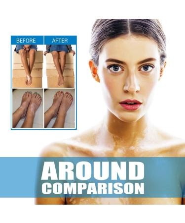 USLEAN Kolmax Vitiligo Soothing Ointment 20g - Psoriasis and Vitiligo Cream for All Skin - Buy Online on GoSupps.com