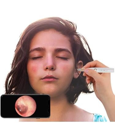 QIYUDS Ear Wax Removal Tool Ear Cleaner Ear Wax Removal Kit 3.9mm Smart Visual Ear Spoon Ear Endoscope high-Definition WiFi All-in-one Otoscope - Buy Online on GoSupps.com