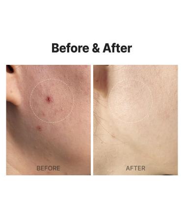 MEDITHERAPY A Clearing Gel Cleanser | Pore Tightening Vegan Face Wash | Korean Skincare Alcohol-Free Heartleaf | 5.07 fl. oz - International Shipping Available - Buy Online on GoSupps.com