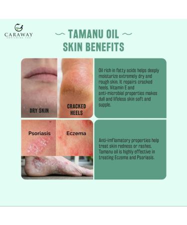 CARAWAY Organic Tamanu Oil - Cold Pressed Natural Moisturizer for Skin Hair & Face - Treats Hyperpigmentation Acne Scars Eczema & Psoriasis - 1.7 Fl oz (50 ml - Buy Online on GoSupps.com
