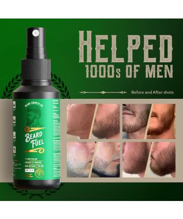 Beard Growth Serum 5% Minoxidil with Biotin - 2 Fl Oz (Pack of 1) - Buy Online on GoSupps.com