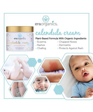 Organic Calendula Cream for Babies | Soothing Baby Lotion for Sensitive Skin, Eczema, Cradle Cap, Acne | With Cocoa Butter, Rosemary, Zinc Oxide - Buy Online on GoSupps.com