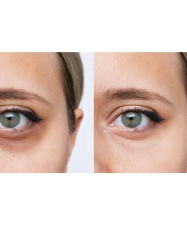 ACQUAGRAPH Eye contour with ingredients of natural origin Anti-wrinkle eye contour Anti-dark circles Firming. Paraben-free eye contour. Dermatologically tested. All ages.15ml - Buy Online on GoSupps.com