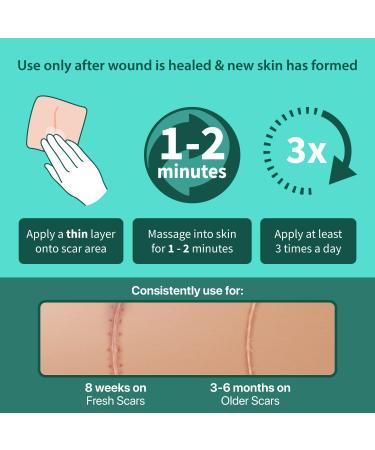 Ebanel Silicone Scar Gel with Onion Extract, Emu Oil, Vitamin E - Medical-Grade Cream for Scar Removal & Stretch Marks - Acne, Burn, Surgical Scars, Injuries, C-Section, Insect Bites - Buy Online on GoSupps.com