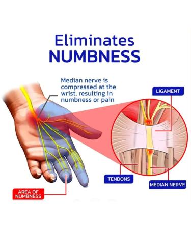 2 Pack Gfouk Numbfix Hand & Foot Spray - Relief for Joint Pain & Tenosynovitis - Fast Shipping Worldwide - Buy Online on GoSupps.com