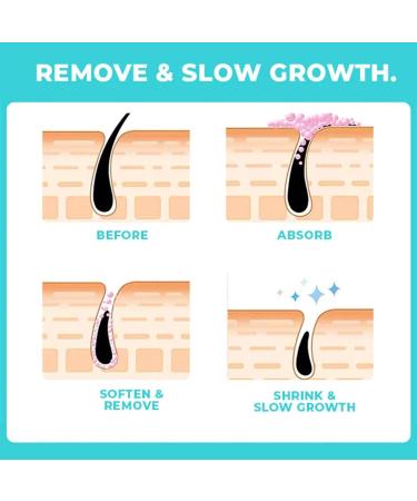 Skinetic Peach Fuzz Hair Removal Cream - 100g Gentle Face Hair Remover for Women | Mustache & Lip Hair Solution (3 Pieces) - Buy Online on GoSupps.com