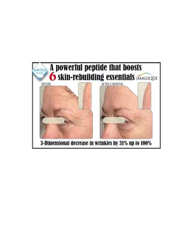 iMagique Age-Defying Eye Gel for Dark Circles and Puffiness with Matrixyl Haloxyl & Eyeliss - Anti-Aging Treatment for Fine Lines & Wrinkles - Buy Online on GoSupps.com