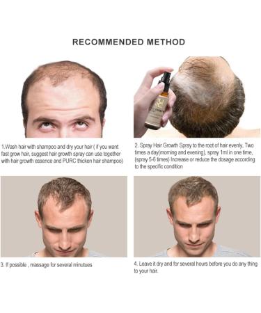 DUBUSH Purc Natural Hair Growth Serum & Hair Growth Oil Set Purc Natural Ginger Hair Growth Oil Prevent Hair Loss Scalp Care Fast Hair Growth Products - Buy Online on GoSupps.com