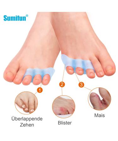 Sumifun Gel Toe Spreader - 10x Small Toe Protection for Overlapping & Curled Toes | Blue Gel Separator for Friction Pain Relief - Buy Online on GoSupps.com