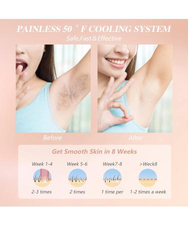 Jitesy IPL Hair Removal Laser Device - 3 Functions (HR/SR/RA) 6 Energy Levels 999 999 Pulses - Permanent Hair Removal for Women & Men - Face Armpits Legs Bikini & Body - Buy Online on GoSupps.com