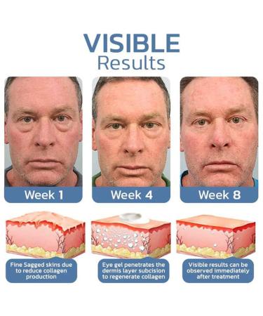 Openeyes Gel - Peptide Lifting Eye Gel for Men & Women | Anti-Aging Eye Serum (15g) - Shop Internationally - Buy Online on GoSupps.com