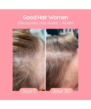 Lashil Beauty - Good Hair Women - Food Supplements - Anti-Hair Loss - Made in France - Venus Hair Biotin Iron Zinc MSM Vitamin B6 B12-120 Gummies - Buy Online on GoSupps.com