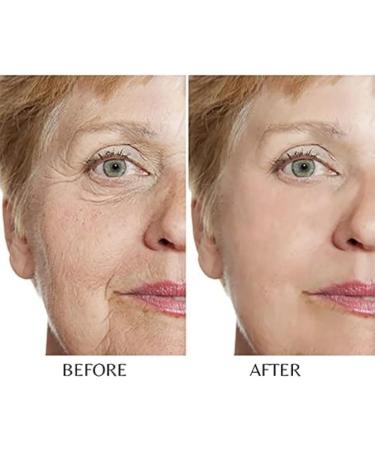 Wrinkle Smoothing Capsules Advanced Formula With Hyaluronic Acid Wrinkle Capsules (2Boxes) - Buy Online on GoSupps.com