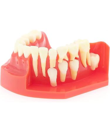 Lmeil Silicone Tooth Development Model for Children | Milk Teeth & Deformality Education Tool - Buy Online on GoSupps.com