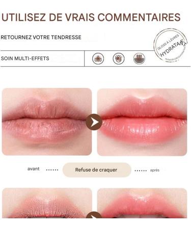 Moisturizing Lip Balm - Long-Lasting Nourishing Lip Care for Women Soothing Makeup Product Non-Greasy Lipstick for On-the-Go Use - Buy Online on GoSupps.com