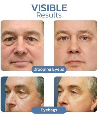 OPENEYES Awaken Peptide Lifting Eye Gel OPENEYES Peptide Eye Gel openeyes Lifting Eye Gel Peptide Depuffing Eye Gel Men Eye Cream Anti Aging Lifts Firming Anti-Wrinkle Eye Tightener (1PC) - Buy Online on GoSupps.com