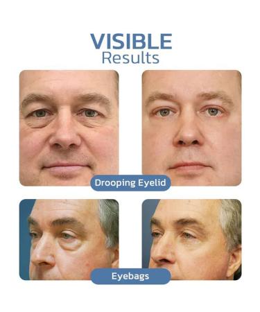 Openeyes Peptide Lifting Eye Gel - Nordizoe Depuffing Eye Cream Set - Buy Online on GoSupps.com