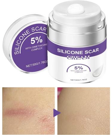 Antiscar cream 50 g scar cream skin care for spots wounds caesarean section old new scars burns legs - Buy Online on GoSupps.com