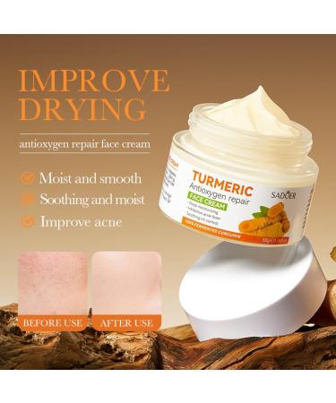 Buy Organic Turmeric Face Cream - Anti-Aging Moisturizer & Dark Spot Remover for Glowing Skin - Hydrating & Acne-Fighting (50g - Buy Online on GoSupps.com