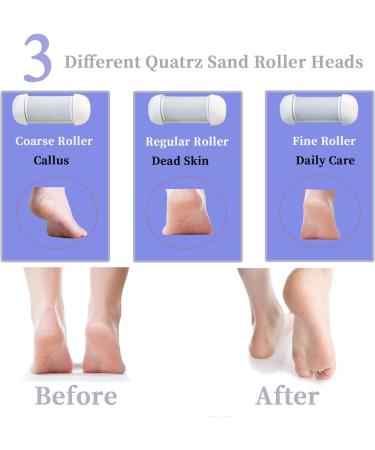 OUXI Electric Foot Callus Remover - Rechargeable 16-in-1 Pedicure Kit with 3 Roller Heads, Waterproof Dead Skin Foot File - 2 Speeds, Pedicure Tools for Men and Women - Buy Online on GoSupps.com