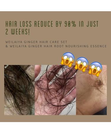 Buy Ginger Hair Root Nourishing Essence | Anti-Hair Loss & Growth Serum - International Shipping Available - Buy Online on GoSupps.com