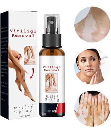 DUBUSH Vitiligo & Psoriasis Relief Spray - Skin Repair Treatment for Reducing White Spots - Soothing & Moisturizing Formula - 1 Pcs - Buy Online on GoSupps.com