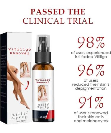 Vitiligo Treatment Spray - Skin Pigmentation Care & White Spot Reduction (2pcs) - Buy Online on GoSupps.com