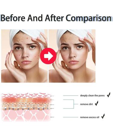 GeRRiT Poreclear 2% BHA Skin Fluid Facial Skin Refining Serum Skin Liquid Facial Exfoliator Facial Exfoliating Serum 2pcs - Buy Online on GoSupps.com