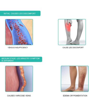 Brrnoo Women's Compression Socks - Lycra & Cotton Anti-Slip Seamless 20-32 mmHg for Leg Trimming & Varicose Vein Prevention - Buy Online on GoSupps.com