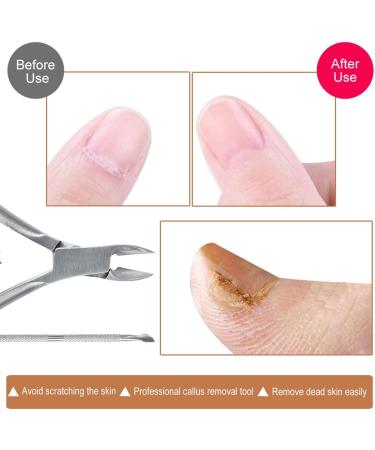 KELYDI Cuticle Nipper and Pusher Set - Dead Skin Remover & Manicure Tool - Buy Online on GoSupps.com