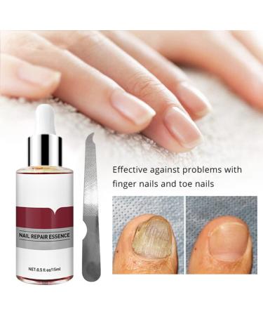 1PC Nail Repairs Nail Treatment Nail Renewal Solution Toenails & Fingernails Nail Repairs Essential Oil Protects From Discoloration Brittle And Cracked Nail(12ML) - Buy Online on GoSupps.com