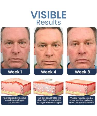 Moisturizing Eye Cream Anti-Puffiness Eye Serum Hydrating Eye Serum for Dark Circles Eye Care Serum Anti-Wrinkle Eye Serum to Reduce Fine Lines - Buy Online on GoSupps.com