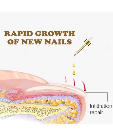 NailGrowth DeepHealing Organic Serum NailGrowth Serum Reconstrux Nail Growth Nail Growth and Strength Serum Nail Growth Serum Nail Repair Essence Serum 30ml (1Pcs) - Buy Online on GoSupps.com