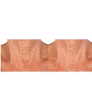 Nakery SkinToning Body Butter | Crepe Smoothing + Repair | Infused with Niacinamide Caffeine Tri-Hyaluronic Acid (Seaside Serenity) - Buy Online on GoSupps.com