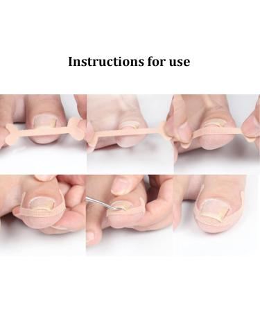 Ingrown Toenail Patch Nail Picker Pedicure Tool 20 Adhesive Stickers Toenail Correction Relief Prevention Suitable for Ingrown Thick Nails - Buy Online on GoSupps.com