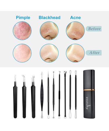 Pimple Popper Tool Kit - 10 Pcs Professional Comedone Extractor for Acne Removal - Buy Online on GoSupps.com
