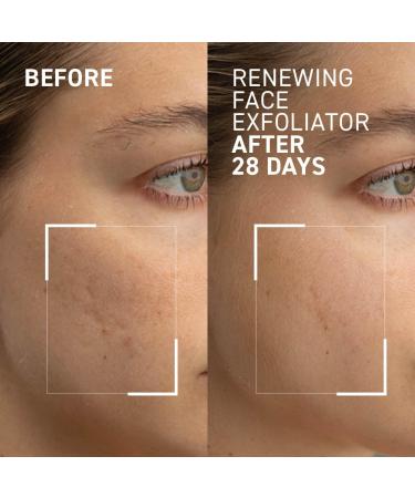 Dr. Brandt Microdermabrasion Renewing Face Exfoliator - Best Exfoliating Scrub for Dull Skin Fine Lines & Acne Scars - 2 oz International Shipping - Buy Online on GoSupps.com