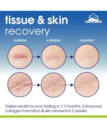 Wound Healing Scar Pills - Made in USA for Surgery Recovery & Support - Reduce Scarring, Bruising, Swelling - Fast Recovery from Plastic & Breast Surgery - Buy Online on GoSupps.com