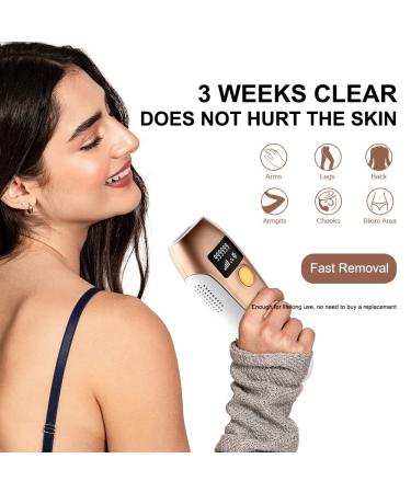 LESCOLTON IPL Hair Removal Device - 999,999 Flashes, Painless Laser Hair Removal for Men and Women - Epilation for Body and Face - Buy Online on GoSupps.com