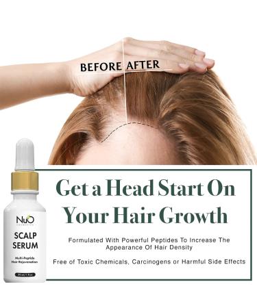 Buy NuOrganic Dry Scalp Serum - Hydrate Hair Follicles Reduce Hair Loss & Itch - Vegan & Organic (1 fl. Oz / 30ml) - International Shipping Available - Buy Online on GoSupps.com