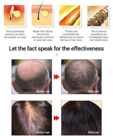 MKKENLEY Magic Hair Growth Tonic with Ginseng for Fast Hair Growth | Best Treatment for Men and Women with Baldness | Nourishing Scalp and Anti-Hair Loss Formula for Hair Regrowth - Buy Online on GoSupps.com