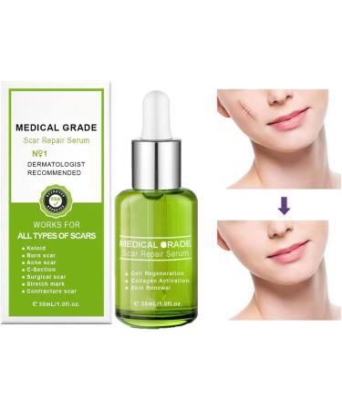 Goopgen Advanced Scar Repair Serum - Nature Scar Treatment for Acne, Surgical Scars, and Stretch Marks (1pcs) - Buy Online on GoSupps.com