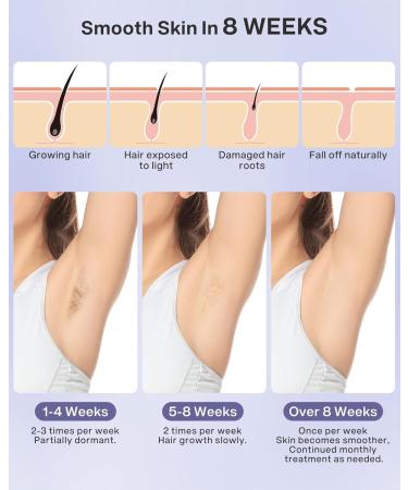 Laser Hair Removal Device for Women & Men | Permanent At-Home Hair Remover for Face Body & Bikini - Safe & Effective - Buy Online on GoSupps.com