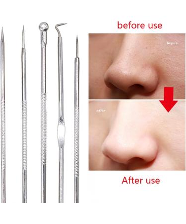 Acne Needle Needle Tool Face Cleaning Blackheads Acne Removal Comedone Extractor Black Head Blemish Pimple Remover Tool Pore Cleaner (Color : 5pcs Style 1) - Buy Online on GoSupps.com
