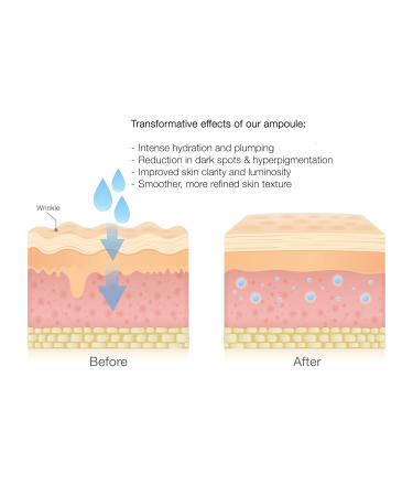 Dr. Song Tremella Sun Repair Ampoule - Exfoliating Serum with Azelaic Acid 10% and Glycolic Acid 10% - Buy Online on GoSupps.com