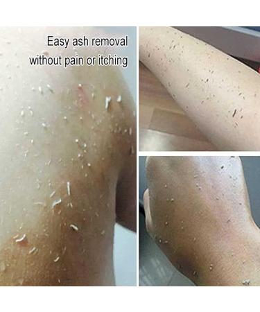 Superpeeler Dead Skin Sponge 2pcs - Exfoliating Bath Body Shower Sponge for Callus Removal - Reusable & Ultra Soft - 4pcs Mix - Buy Online on GoSupps.com