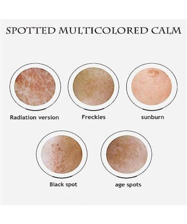 EXQST Dr Hancy Freckle Whitening Cream Moisturizing Repair Cream 20g - Buy Online on GoSupps.com