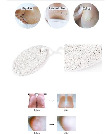 Freshko Skin Polishing Stone - Professional Salon Quality for Home Pedicure, Natural Pumice Stone for Exfoliating Hard Skin, Prevents Corns, Calluses, and Cracked Heels - Buy Online on GoSupps.com